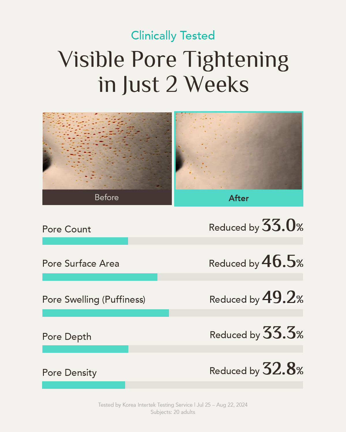 Pore Zero Oil Control Lotion